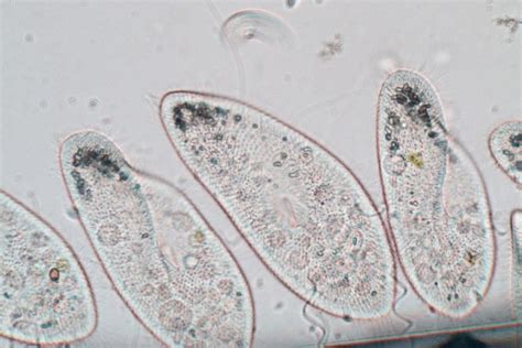  ウロクラゲ、森の底に潜む驚くべき単細胞生物！